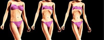 Recognizing Anorexia Symptoms