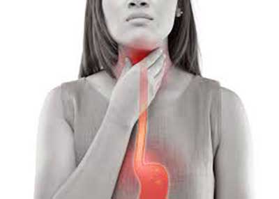 Understanding Gastroesophageal Reflux Disease Symptoms